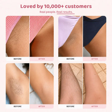 The Peach™ 2-in-1 Face & Body Trimmer — view 2