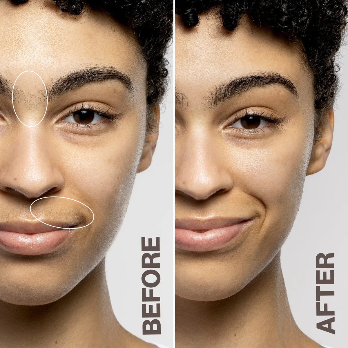 Somnei LUXE+ before and after result 2