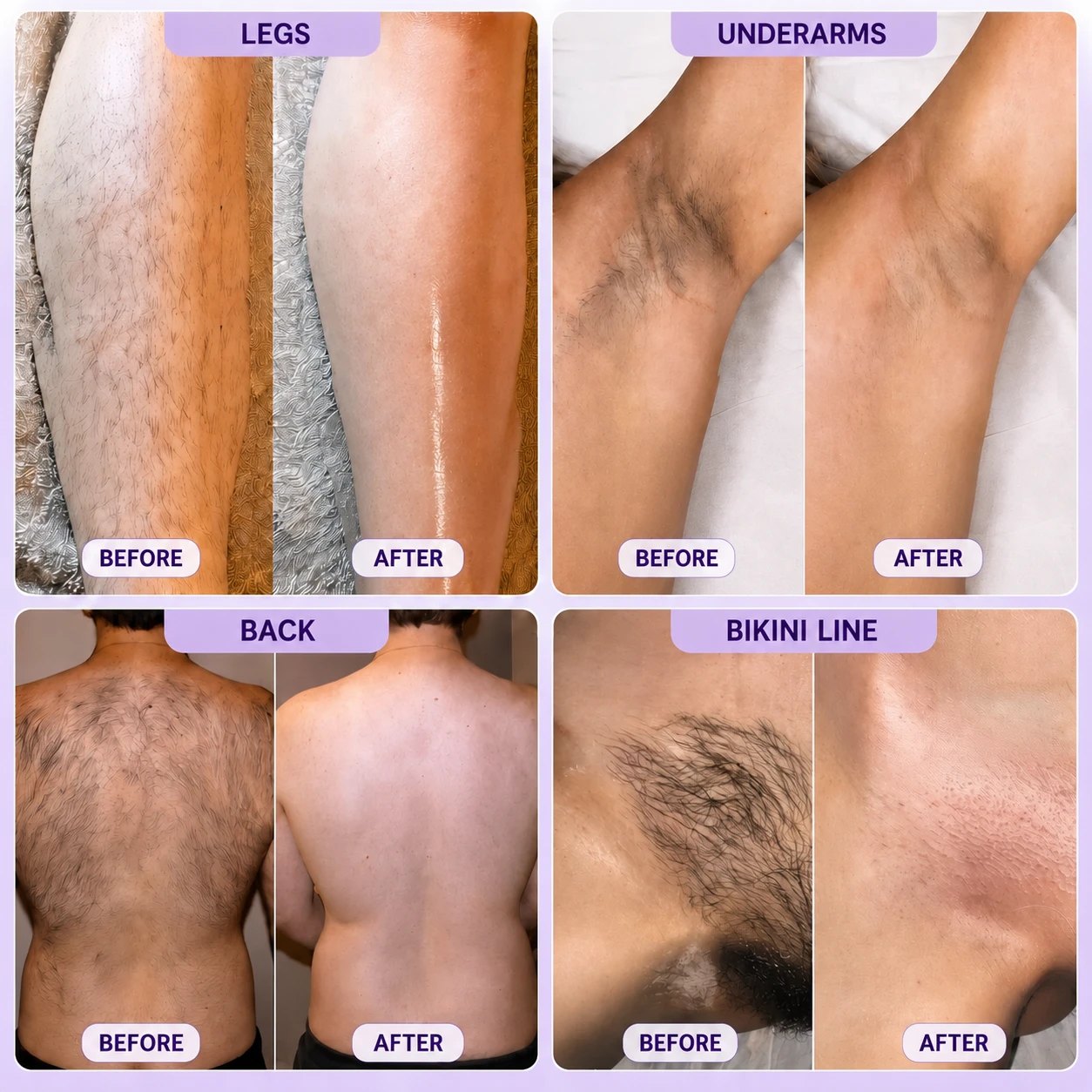 Body Blur Mousse™ Hair Removal Mousse Spray — view 3