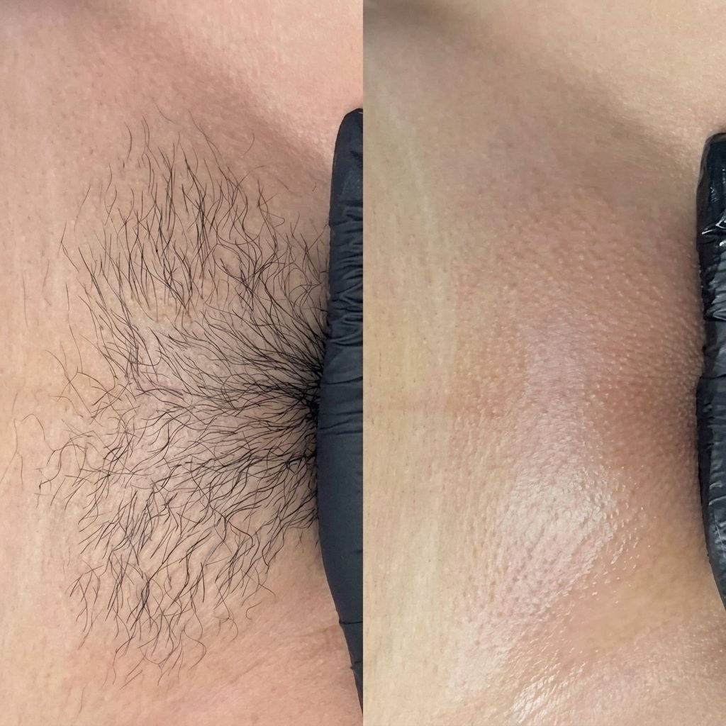 Before and after result 1