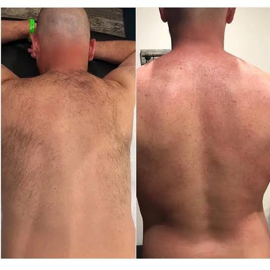 Before and after result 2