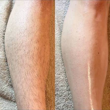 Before and after result 5